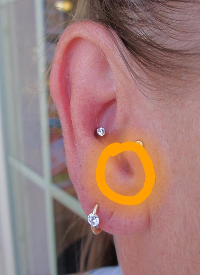 Sign on ear 3