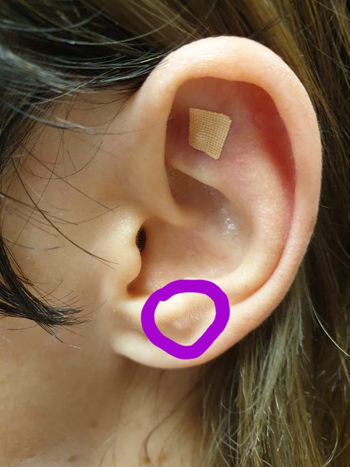 Sign on ear 4